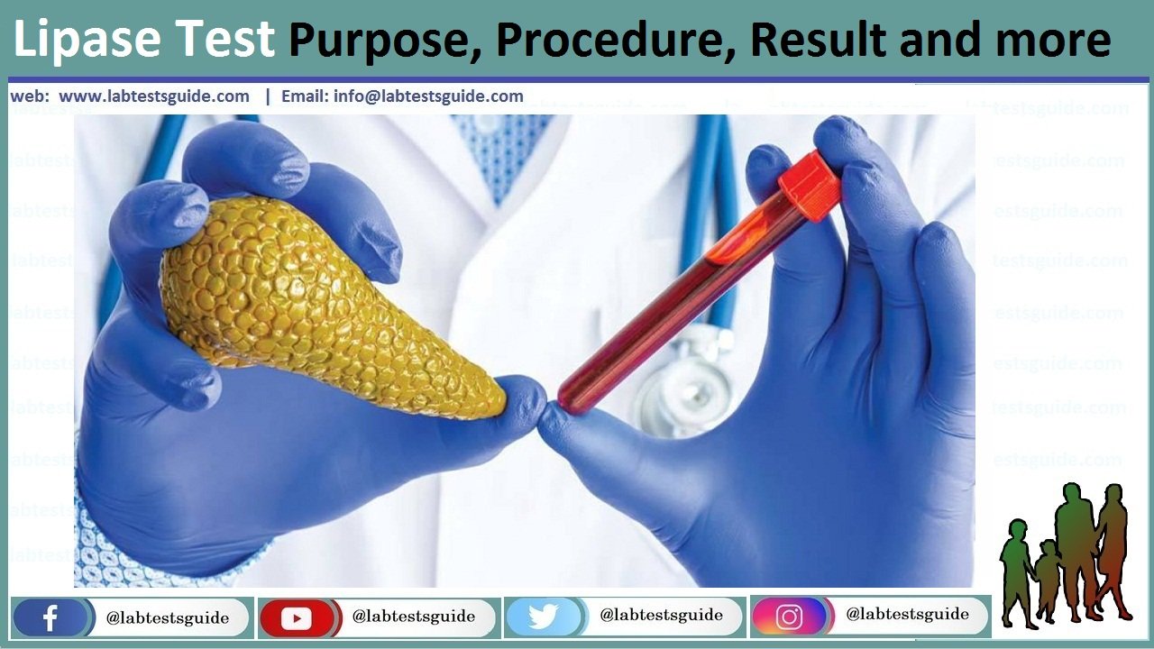 Lipase Lipase Test