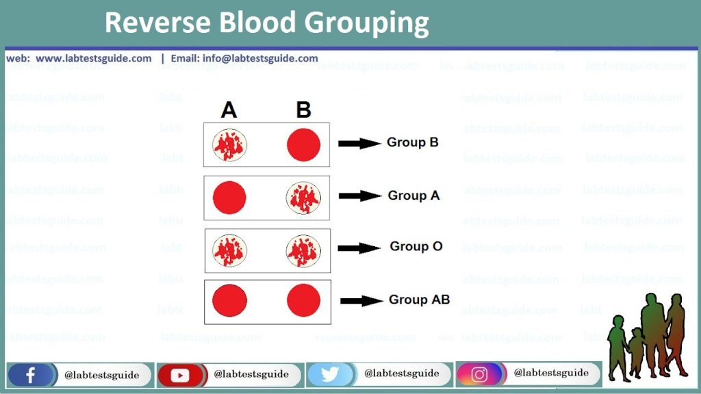 ABO Grouping ABO Grouping - ABO grouping is a test performed to determine an individual's blood type. It is based on the premise that individuals have antigens on their red blood cells (RBCs) that correspond to the four main blood groups: A, B, O, and AB.