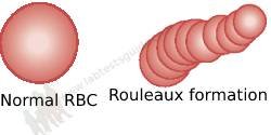 Rouleaux formation