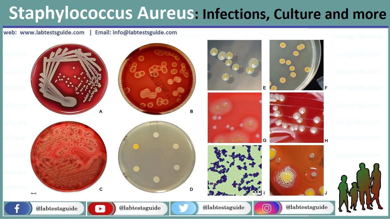 Staphylococcus aureus 4. GRSA стафилококки. Таксономия стафилококка ауреус. Возбудитель стафилококк ауреус. Бемории стафилококки.