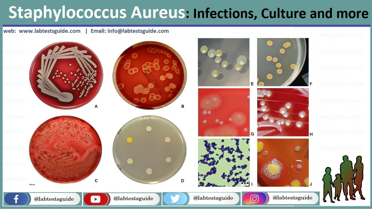 Staphylococcus aureus 4