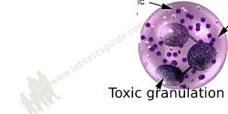 Toxic granulation