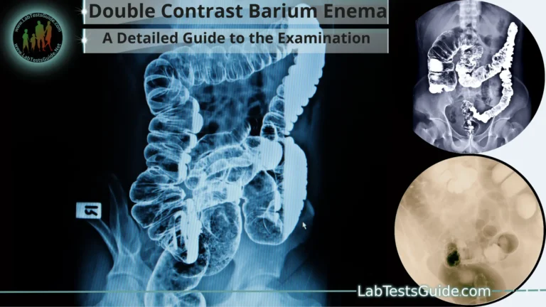 Double Contrast Barium Enema