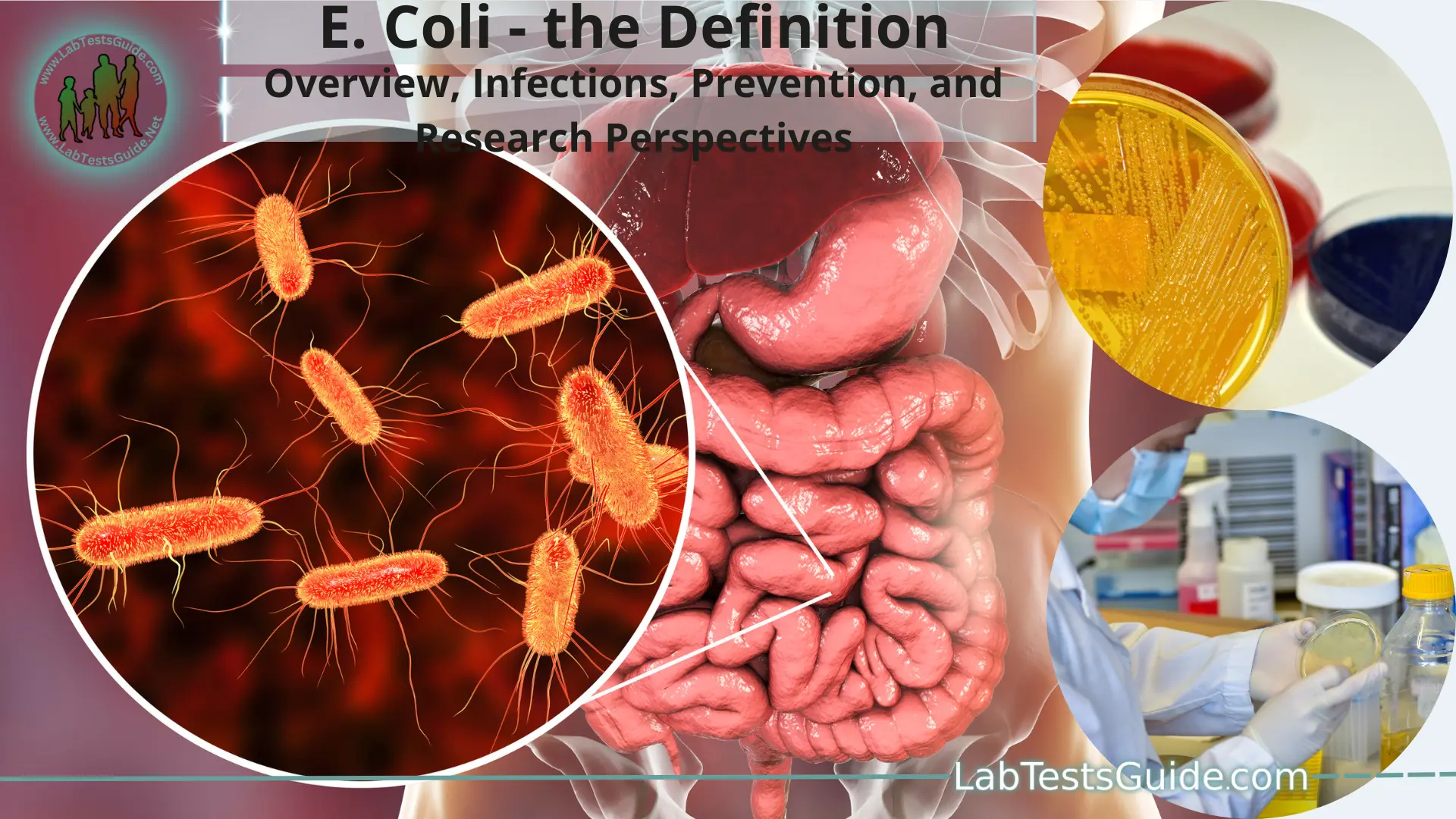 Escherichia coli (E. coli) Overview, Infections, Prevention, and
