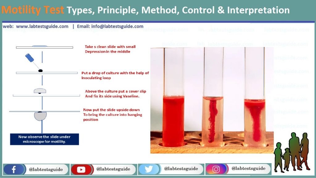 Motility Test Motility Test
