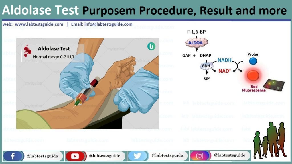 Aldolase Aldolase Test