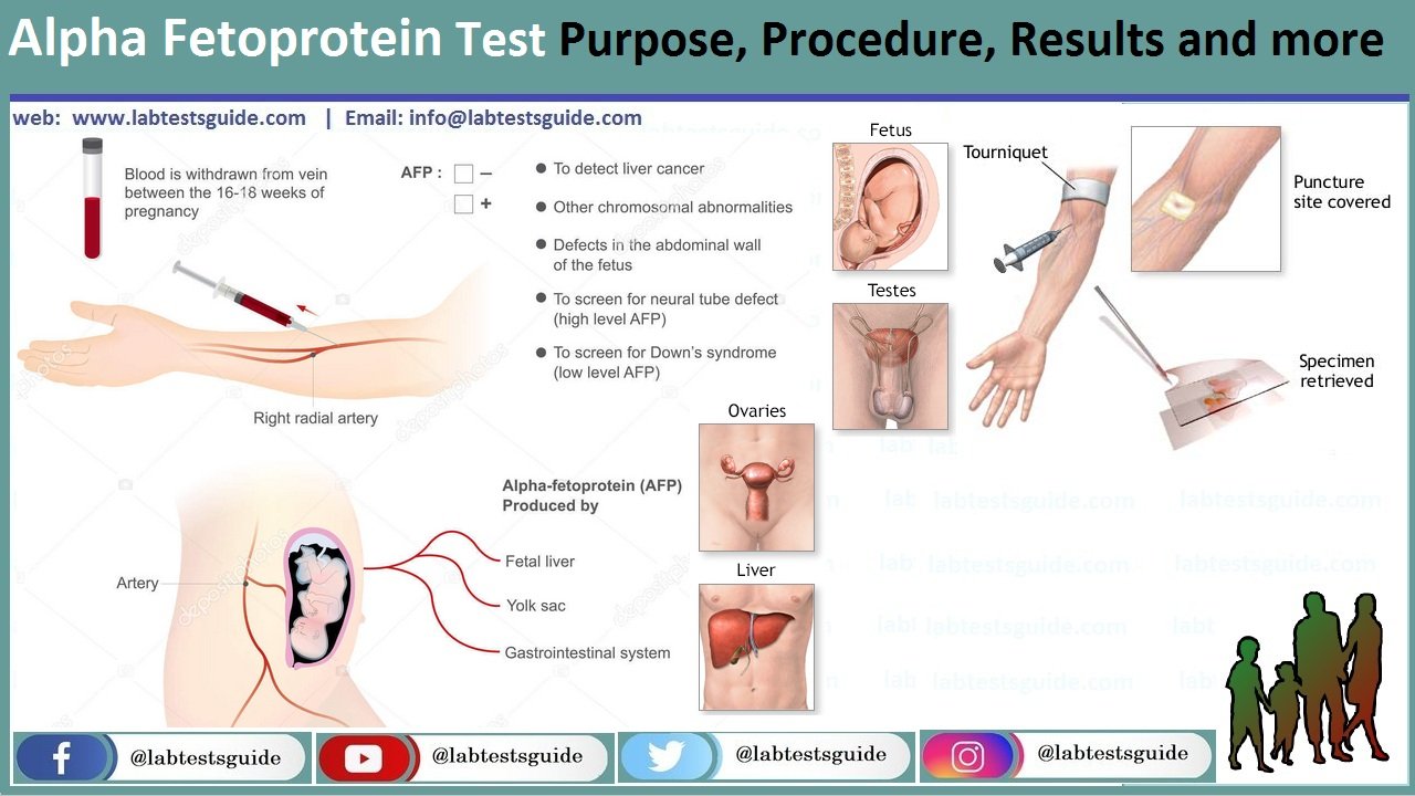 Alpha-fetoprotein (Total) Test Alpha Fetoprotein Test