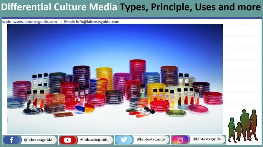 Culture Media Types, Classification, Procedures And More | Lab Tests Guide