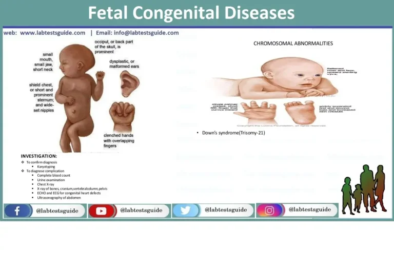 Fetal congenital