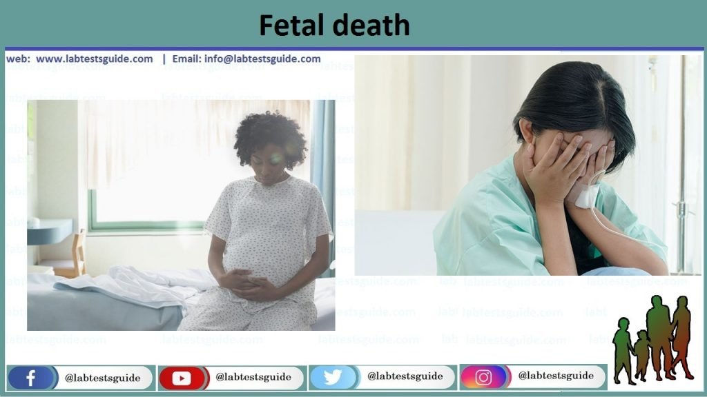 Fetal death Fetal death