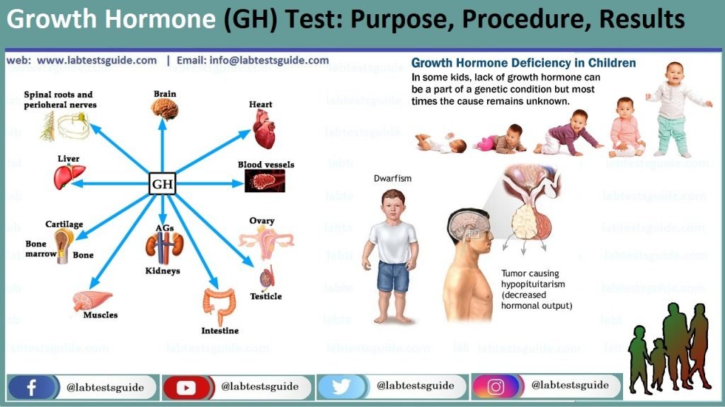 Growth Hormone Suppression Test Growth Hormone