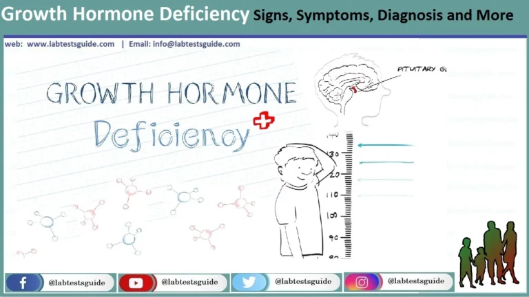 Growth-Hormone-Deficiency
