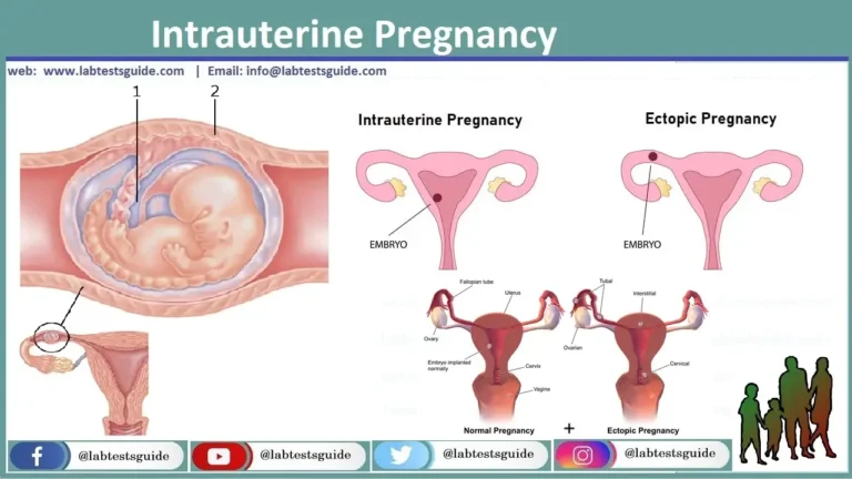 Intrauterine Pregnancy