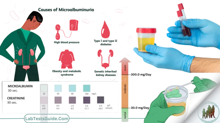 Microalbuminuria Test (Short Aticle)
