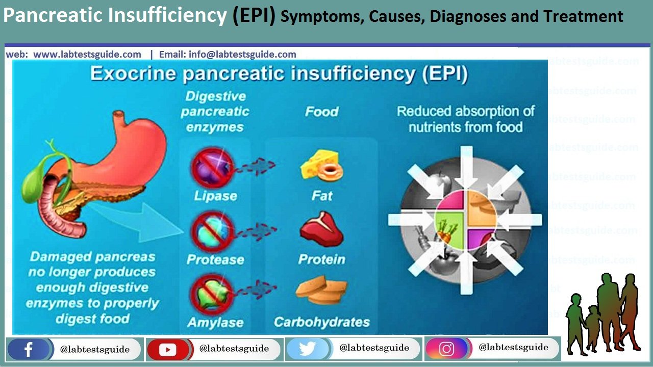 Pancreatic Insufficiency (EPI) Symptoms, Causes, Diagnoses and