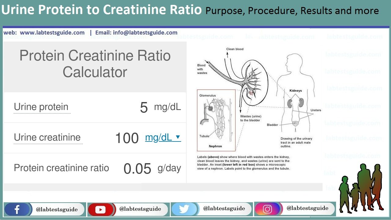 Urine Protein to Creatinine Ratio Purpose, Procedure ...