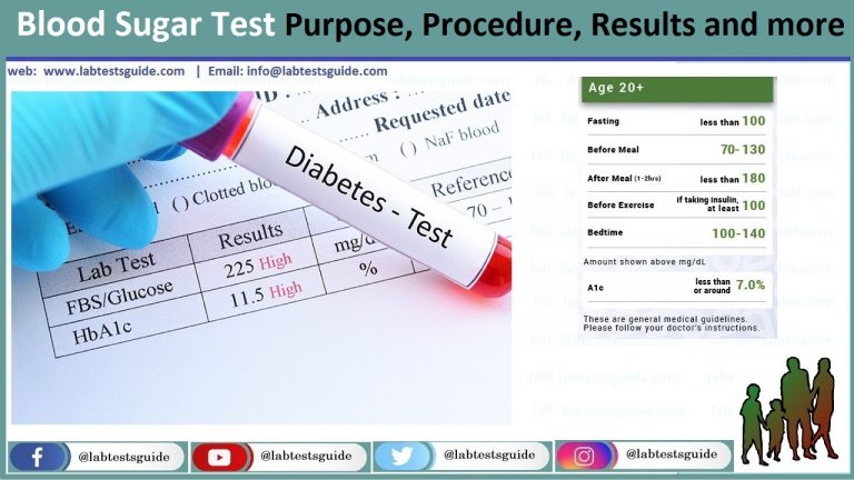 Glucose Test Procedures