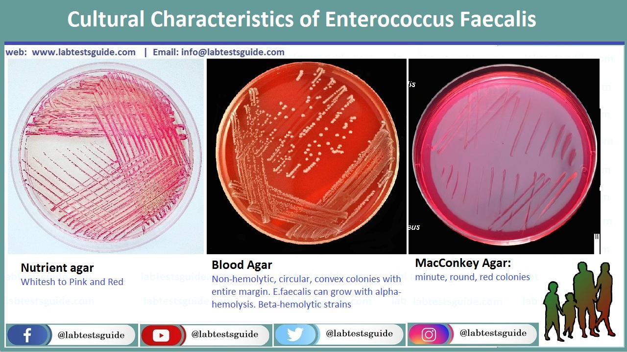 Cultural Characteristics of Enterococcus Faecalis