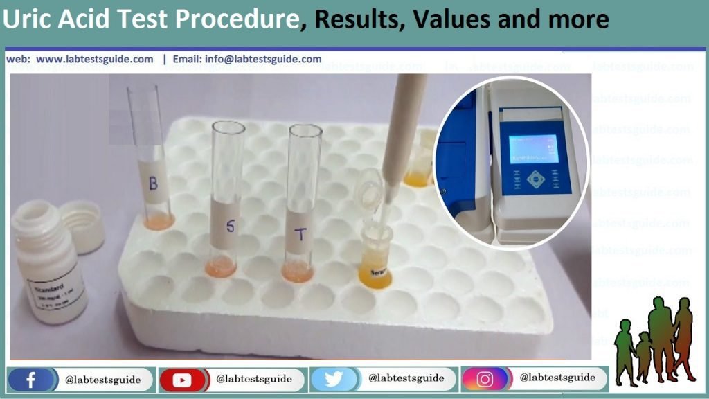 Uric Acid Test Procedure