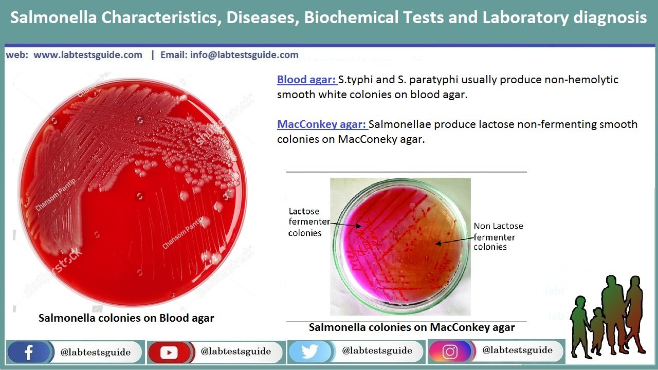 macconkey agar salmonella