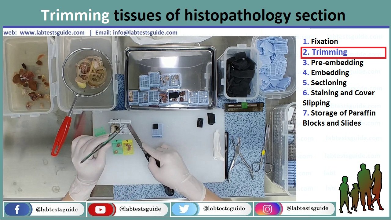 Trimming (Histopathology) Tissue Trimming