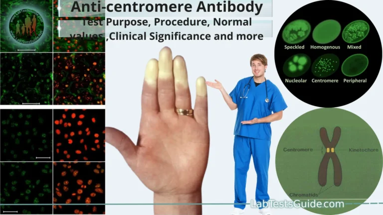 Anti-centromere Antibody