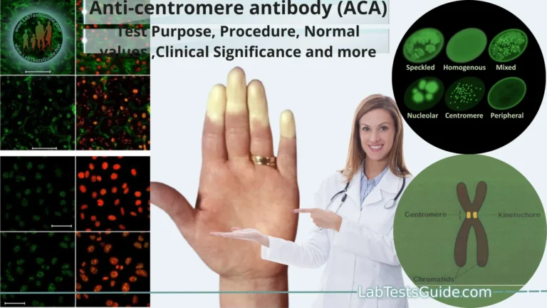 Anti-centromere antibody (ACA)