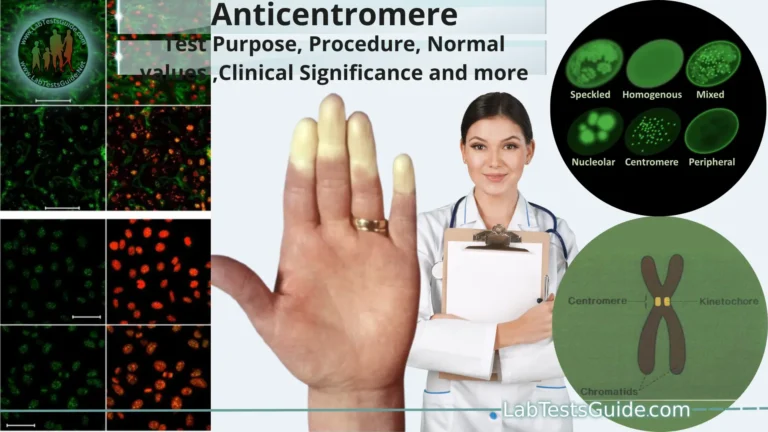 Anticentromere