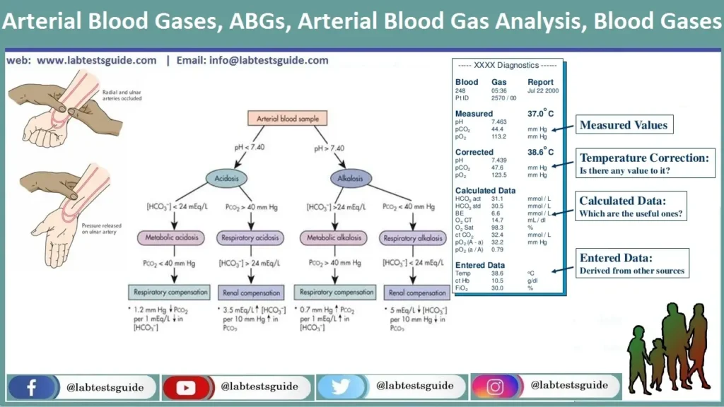Arterial Blood Gases Arterial Blood Gases