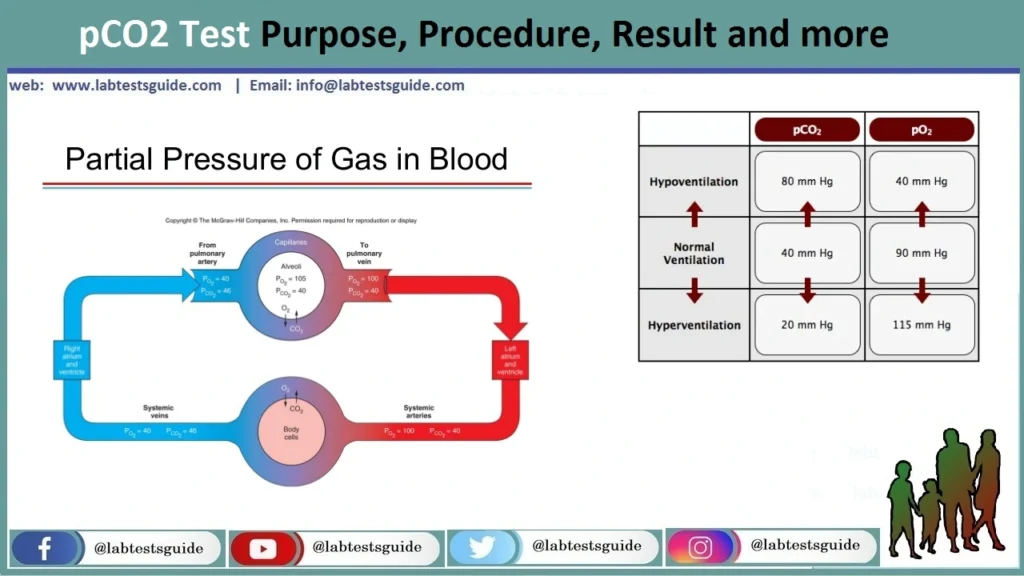 pCO2 (Partial Pressure of Carbon Dioxide) pCO2 (Partial Pressure of Carbon Dioxide)