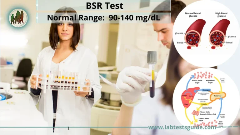 Blood Sugar Random (BSR) Test