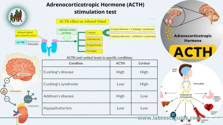 Adrenocorticotropic Hormone (ACTH) stimulation test
