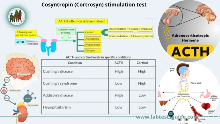 Cosyntropin (Cortrosyn) Stimulation Test