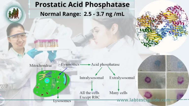Prostatic Acid Phosphatase