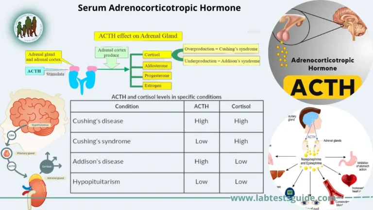 Serum Adrenocorticotropic Hormone