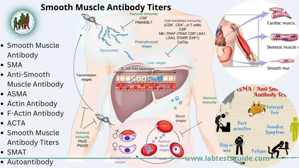 Smooth Muscle Antibody Titers Smooth Muscle Antibody Titers