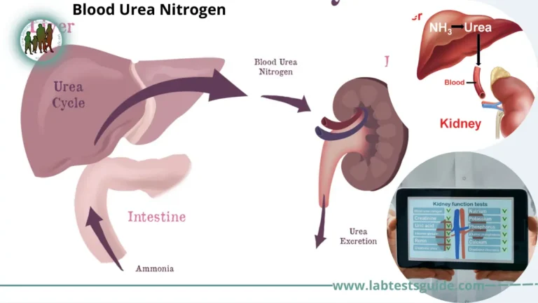 Blood Urea Nitrogen