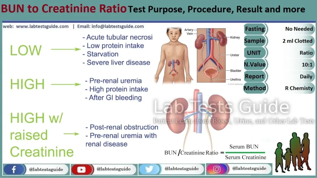 Blood Urea Nitrogen to Creatinine Ratio Blood Urea Nitrogen to Creatinine Ratio