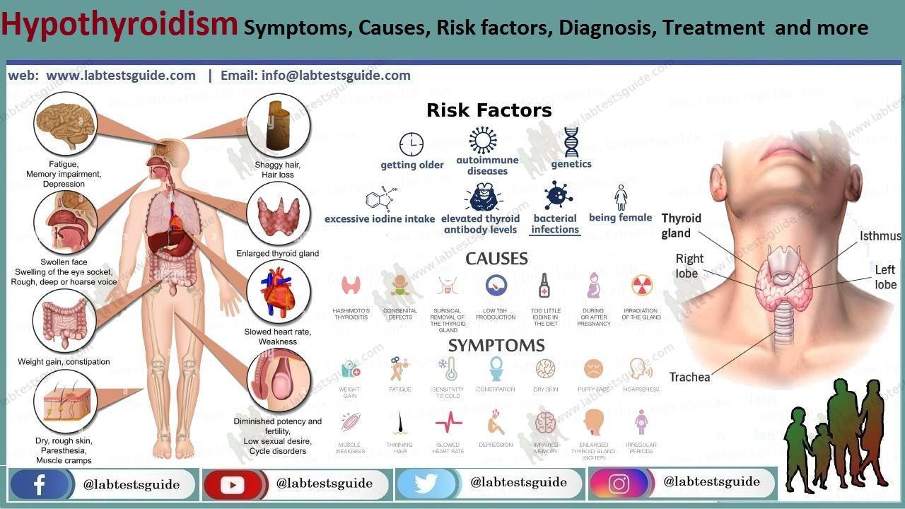 Hypothyroidism