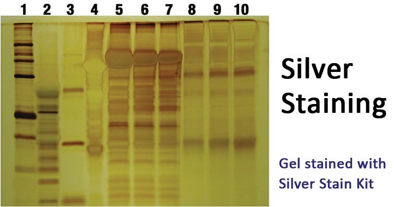 Silver Stain Silver-Staining