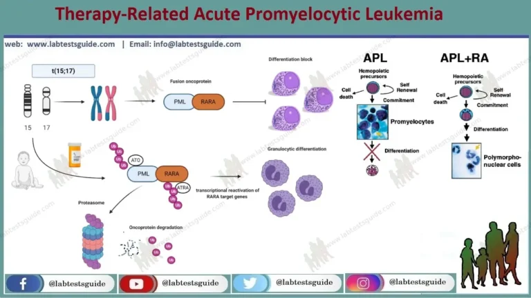 Therapy-Related Acute Promyelocytic Leukemia