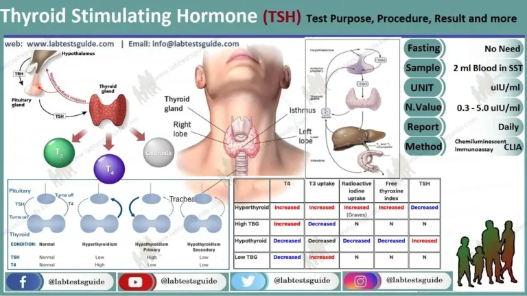 Thyrotropic Hormone