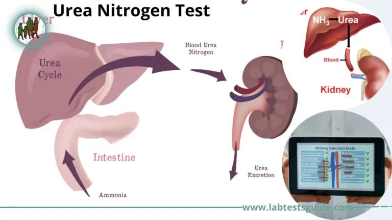 Urea Nitrogen Test