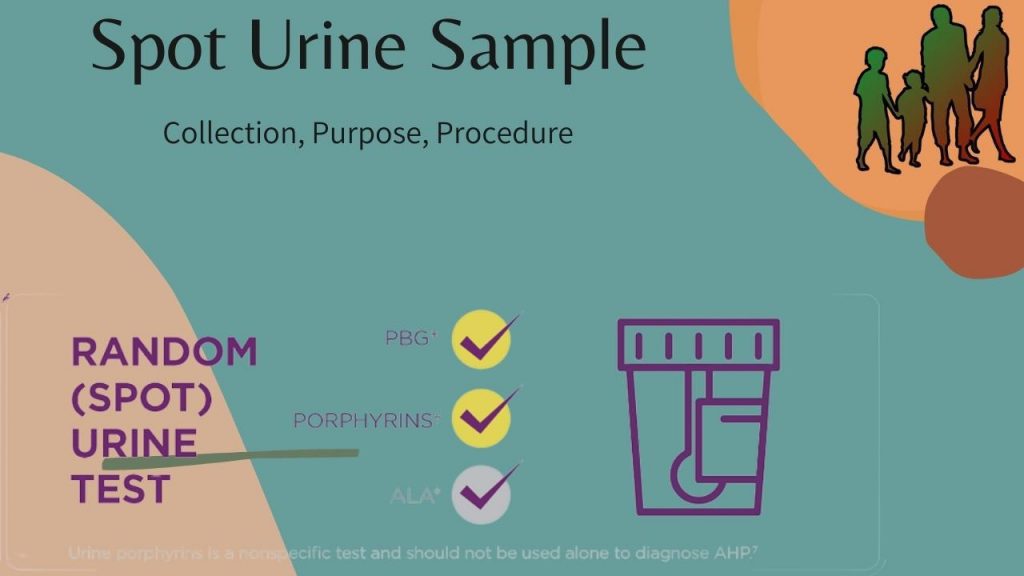Spot Urine Sample