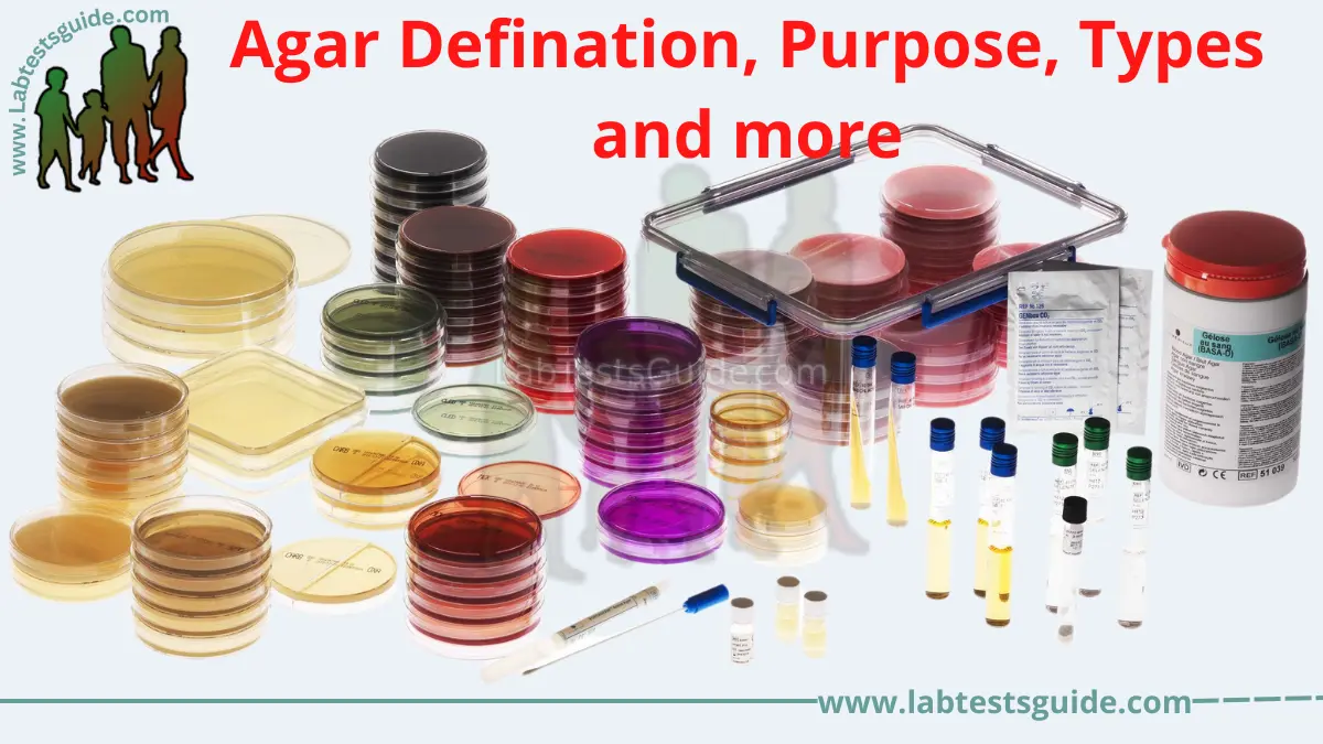 Agar Defination, Purpose, Types and more