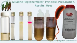 Alkaline Peptone Water, Principle, Preparation, Results, Uses