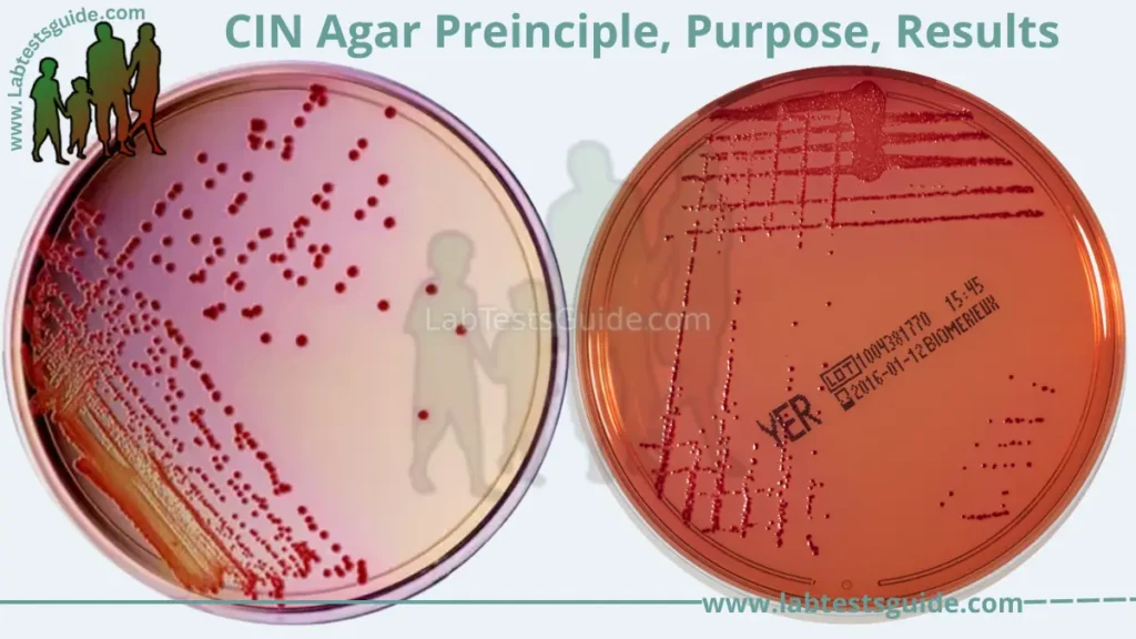 CIN Agar