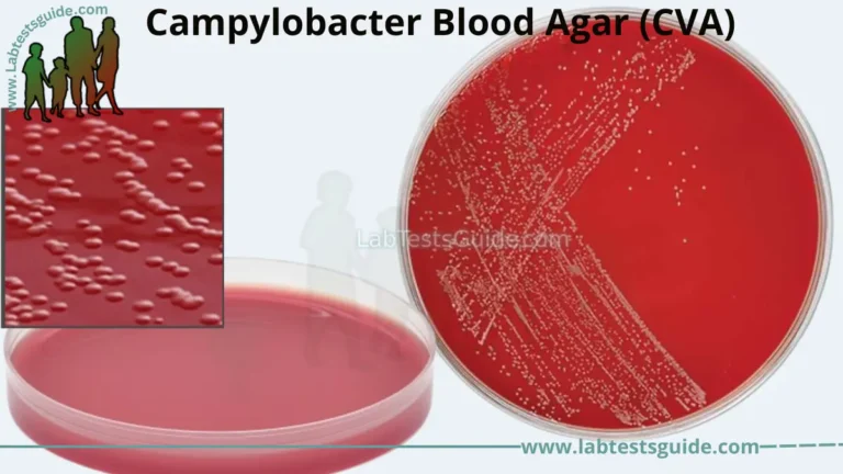 Campylobacter Blood Agar