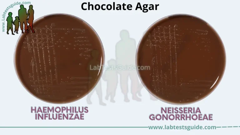 Chocolate Agar