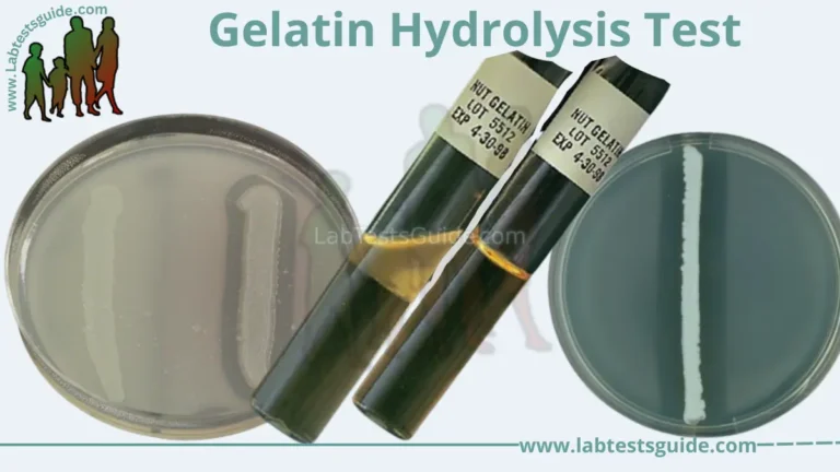 Gelatin Hydrolysis Test